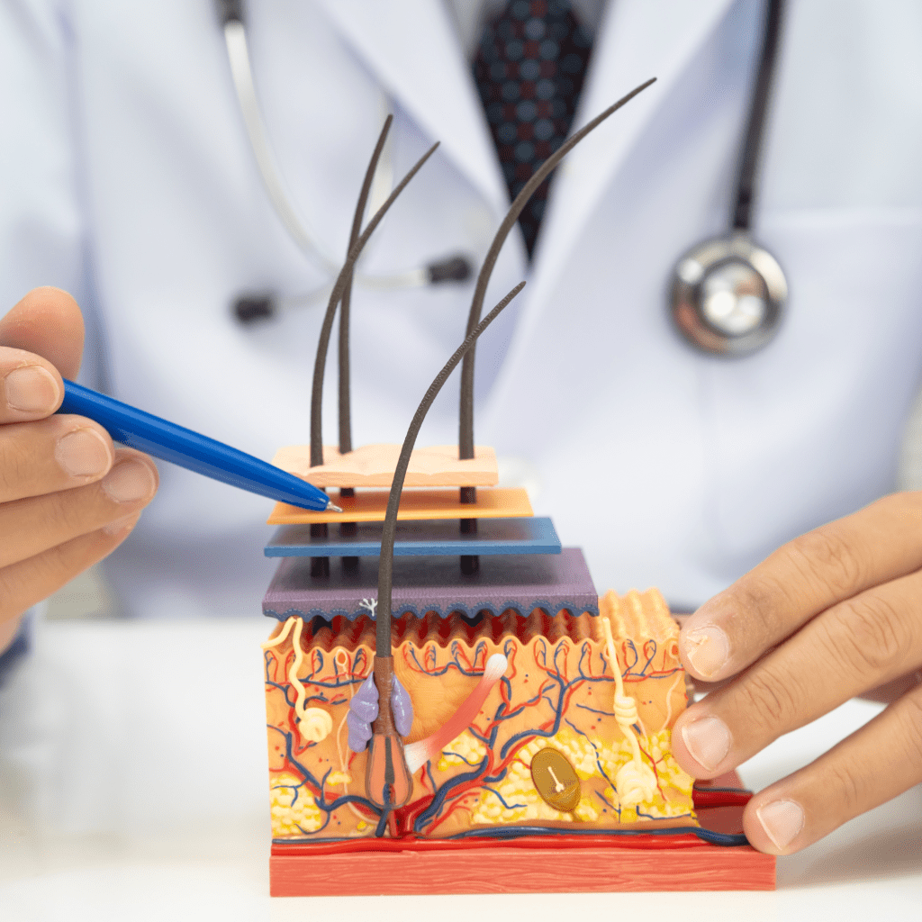 Urticaire chronique spontanée et naturopathie, quelles solutions naturelles?